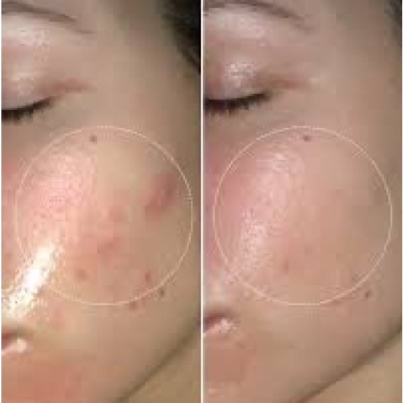 ✨🥇AWARD WINNING!🥇✨BIOSSANCE Squalane + Lactic Acid Resurfacing Night Serum - Picture 9 of 13